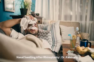 تورم بینی بعد از رینوپلاستی کاور - Nasal Swelling After Rhinoplasty cov