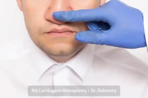 غضروف دنده کاور -