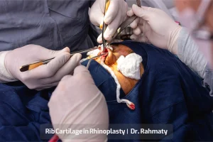 غضروف دنده تصویر - Rib Cartilage in Rhinoplasty