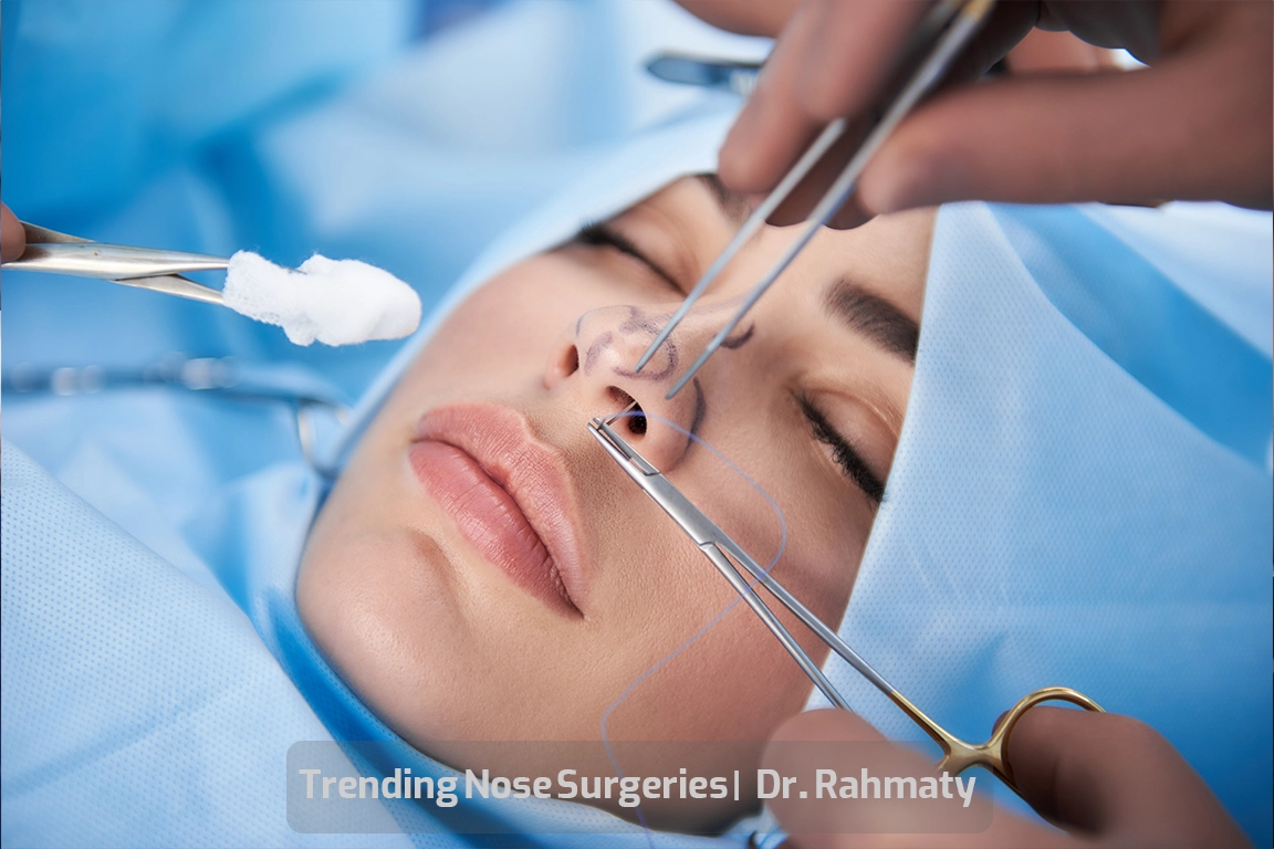 جراحی های بینی ترند تصویر 1 - Trending Nose Surgeries first picture - اتجاهات جراحة الأنف
