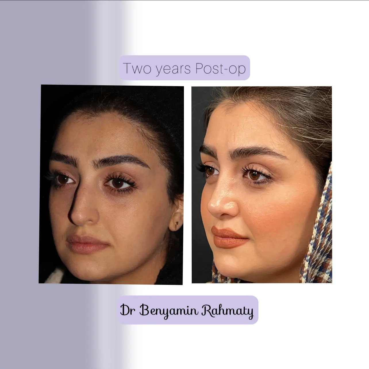 نمونه کار دکتر بنیامین رحمتی