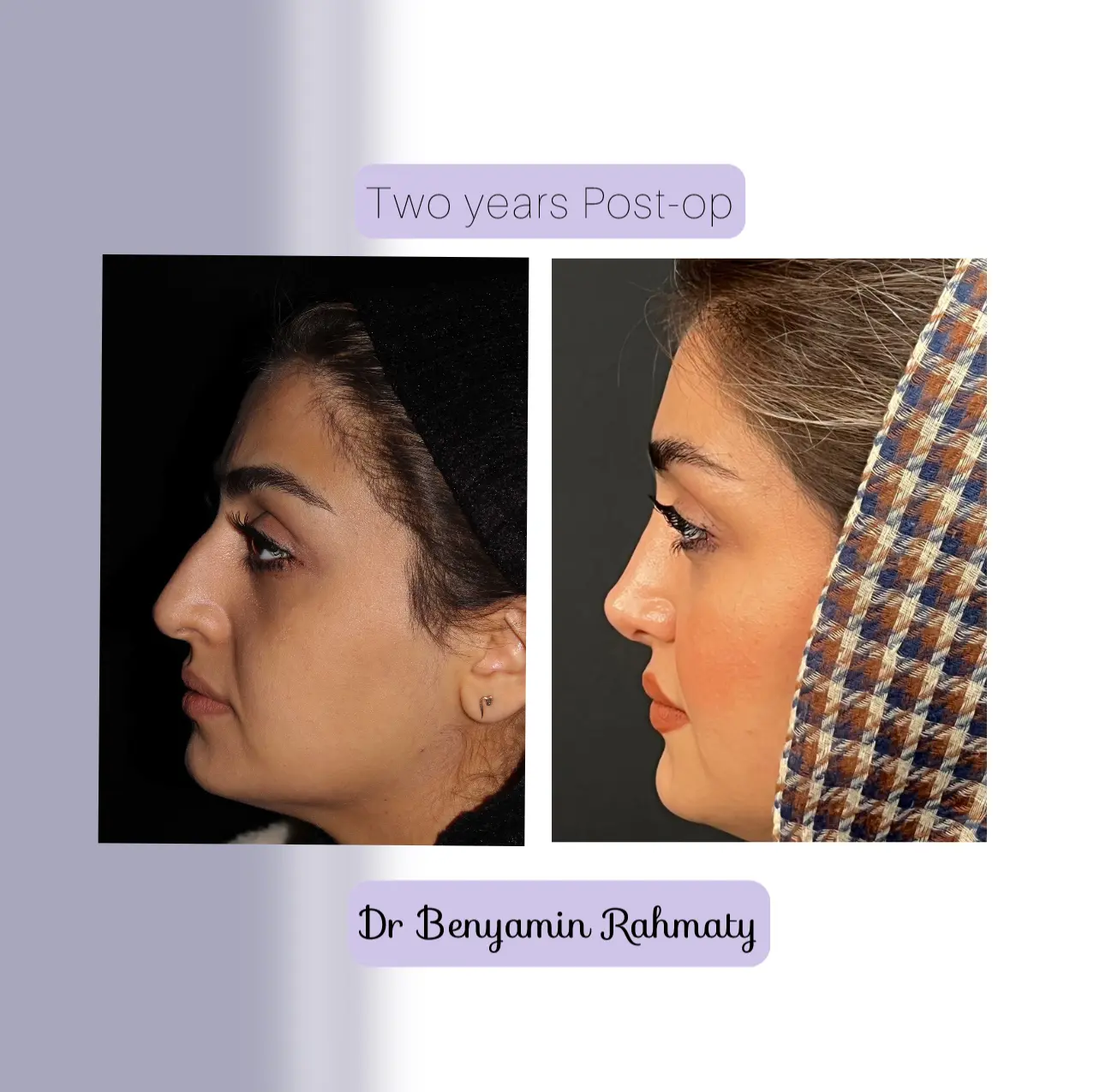 نمونه کار دکتر بنیامین رحمتی