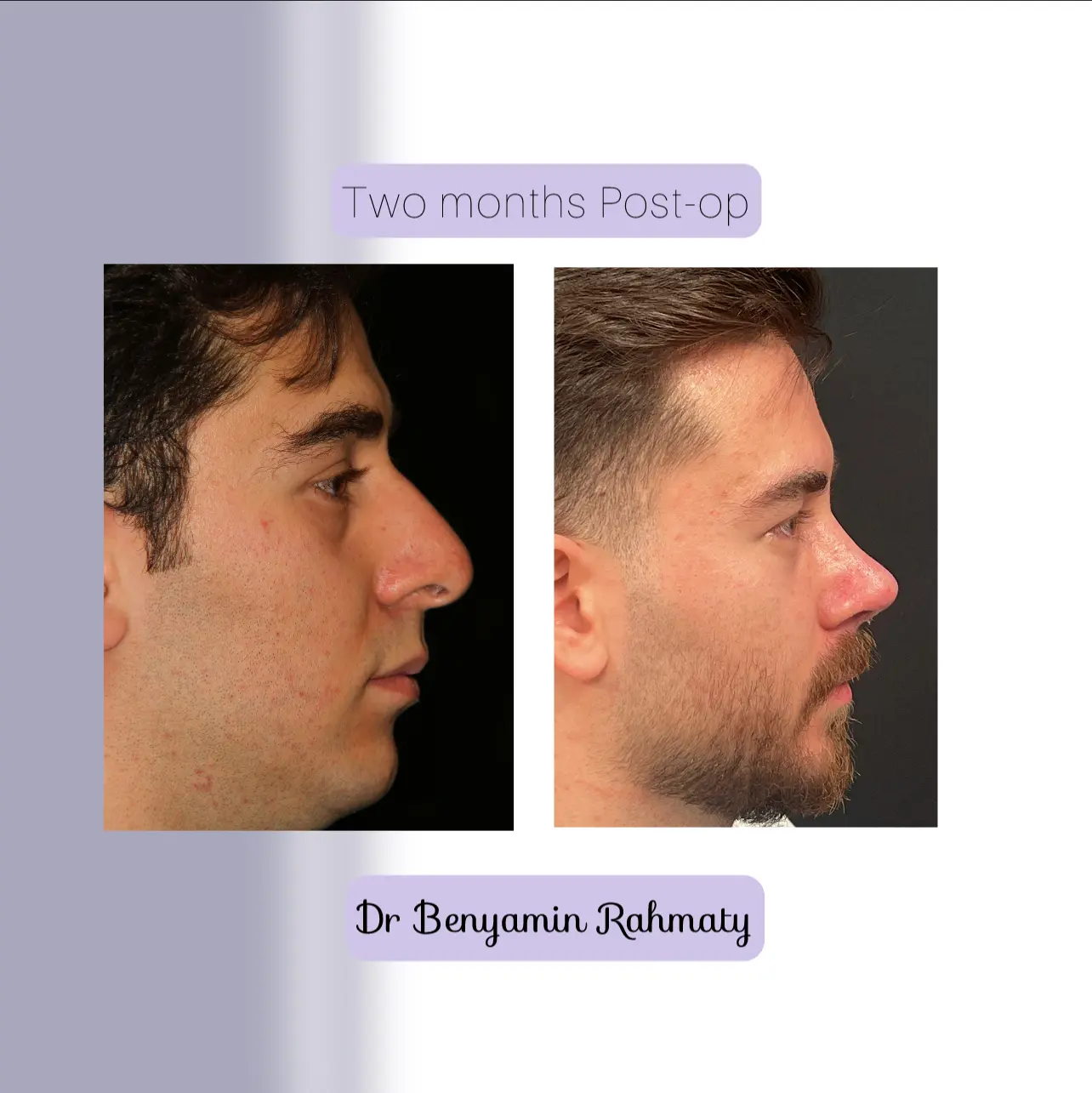 نمونه کار دکتر بنیامین رحمتی