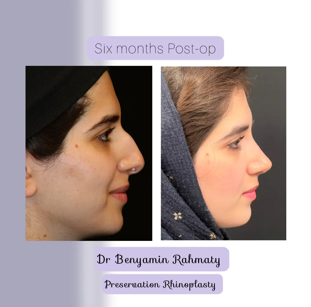 نمونه کار دکتر بنیامین رحمتی