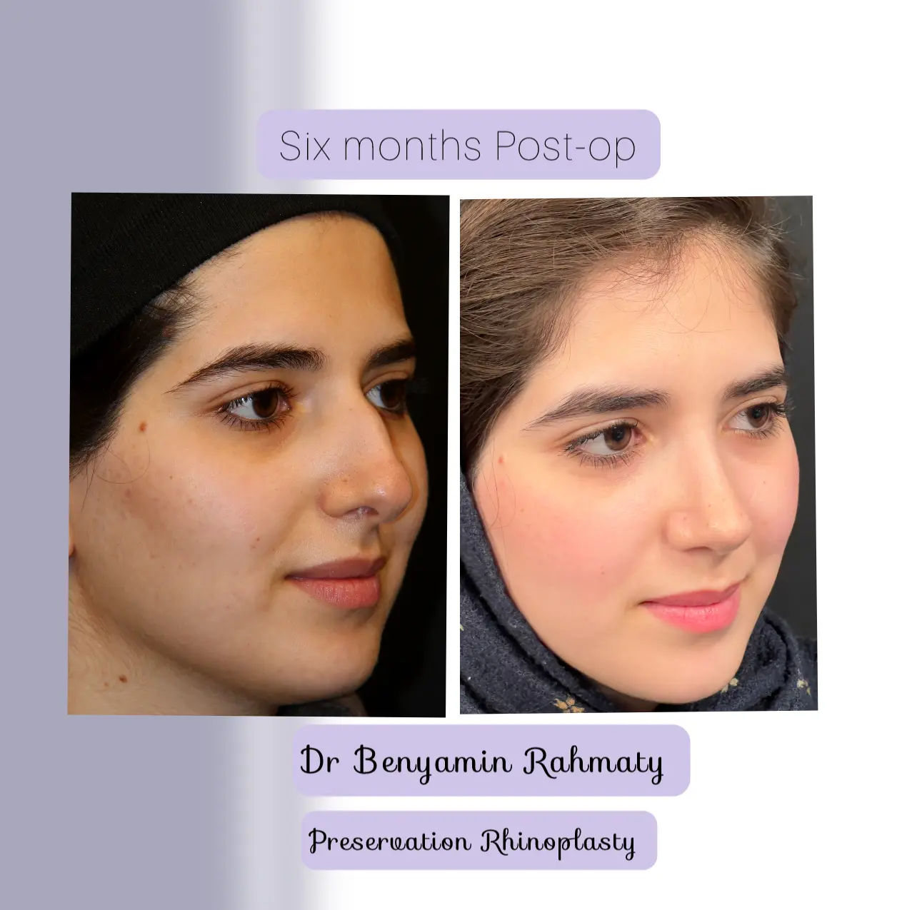 نمونه کار دکتر بنیامین رحمتی