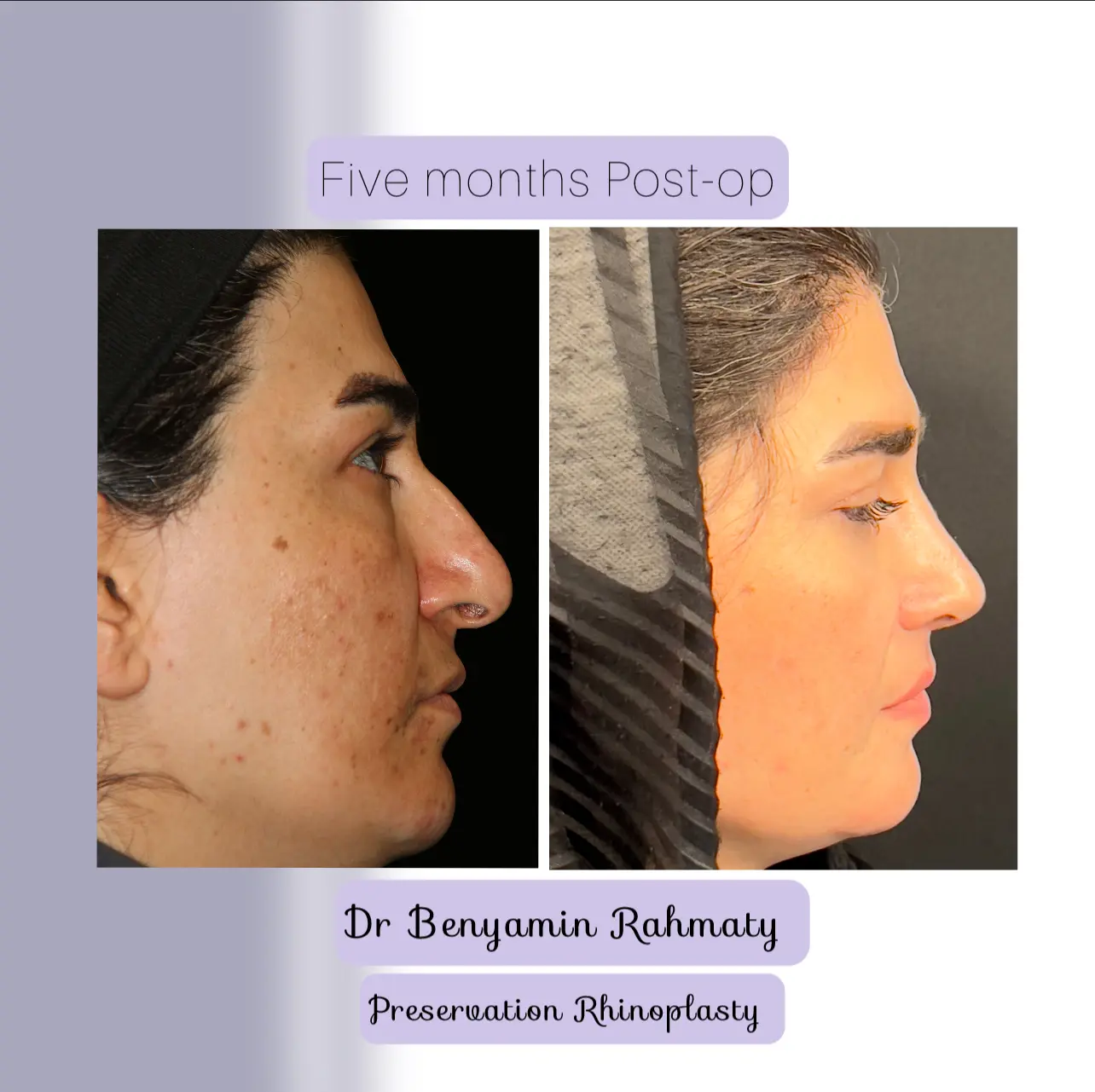 نمونه کار دکتر بنیامین رحمتی
