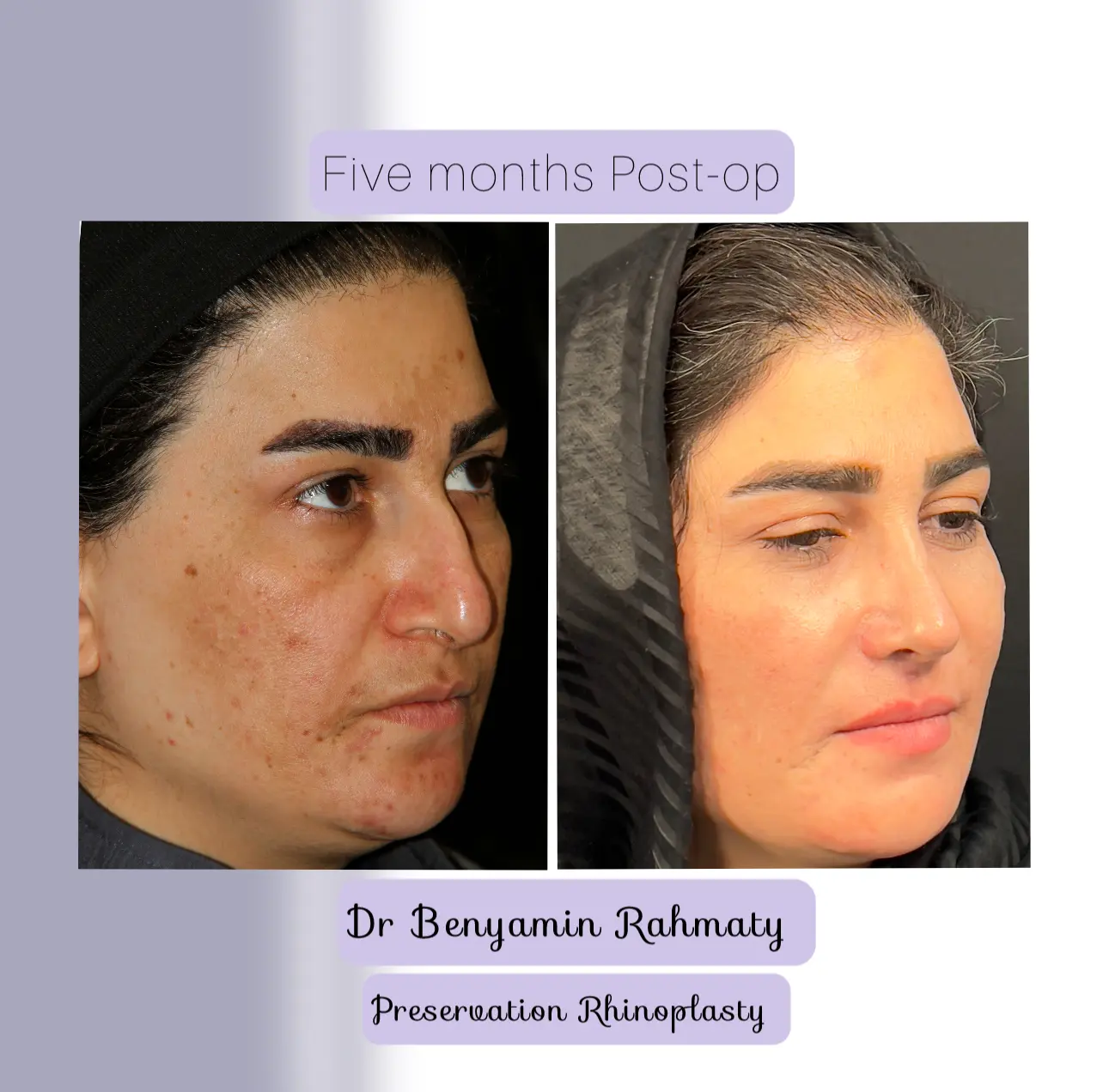 نمونه کار دکتر بنیامین رحمتی