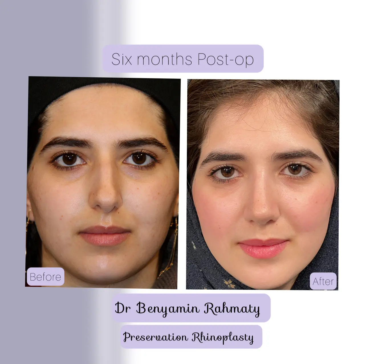 نمونه کار دکتر بنیامین رحمتی