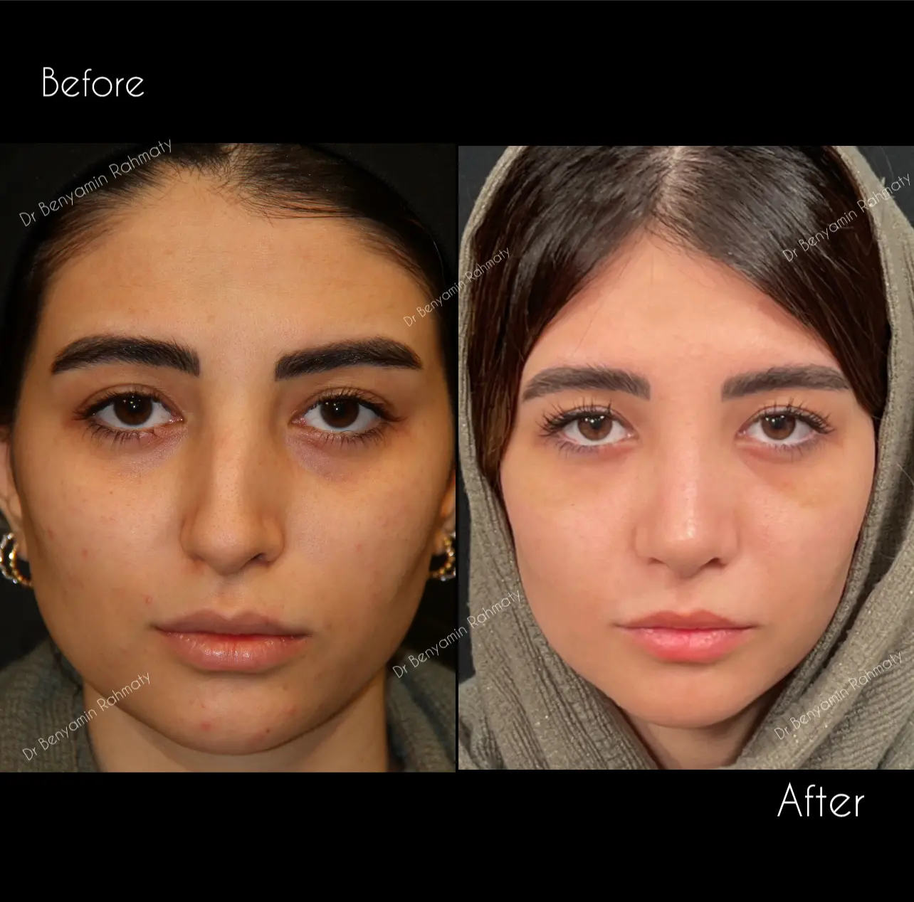 نمونه کار دکتر بنیامین رحمتی