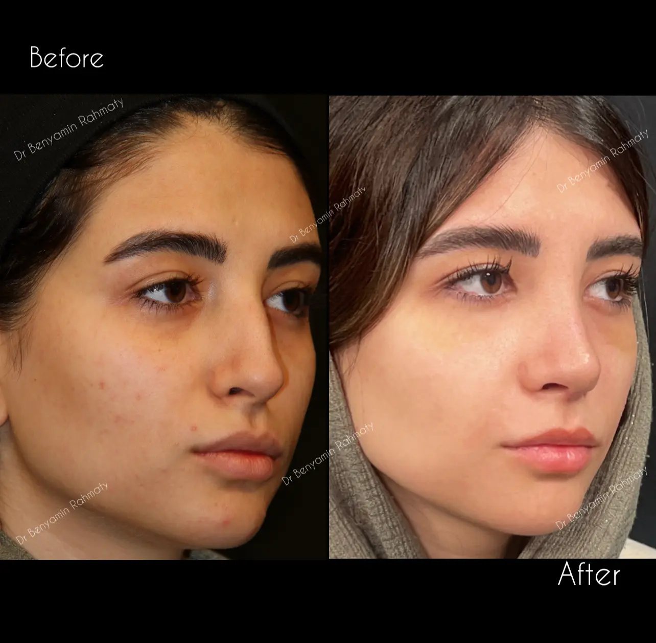 نمونه کار دکتر بنیامین رحمتی