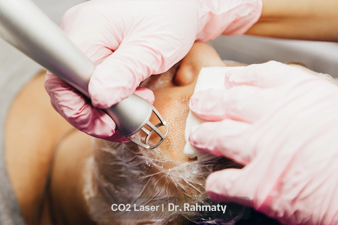 جراحی با لیزر دکا - CO2 laser surgery