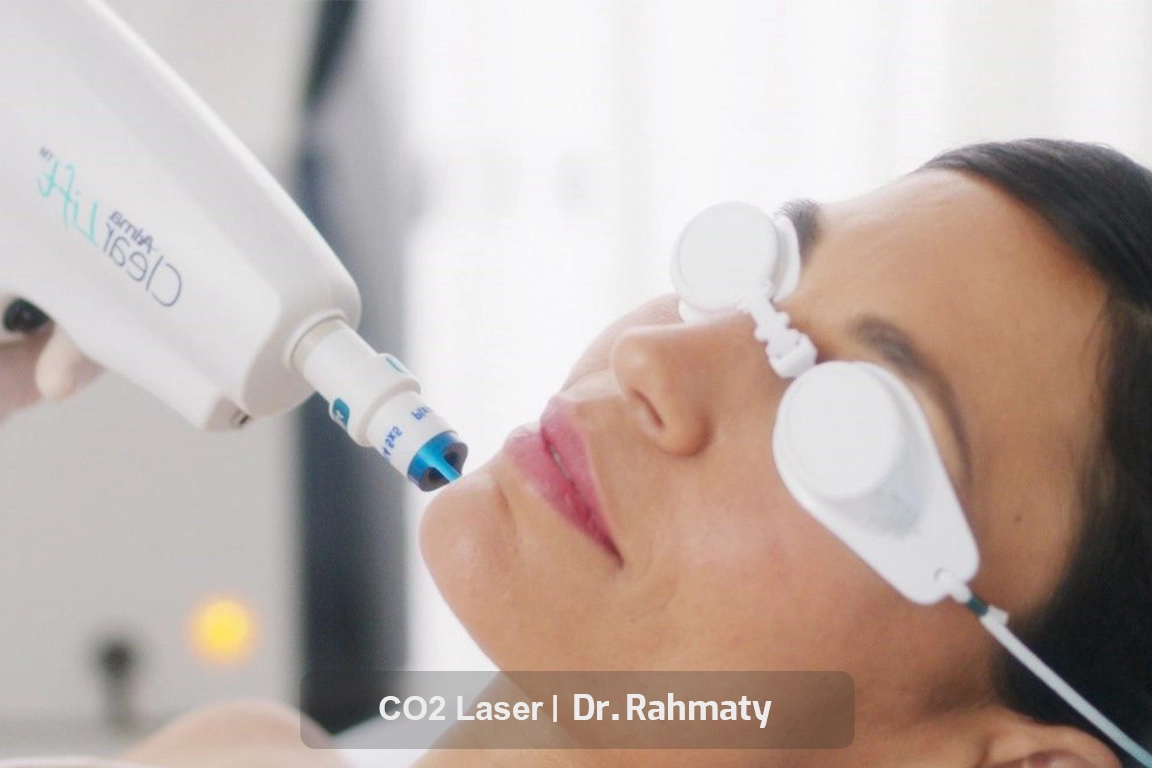 Post-laser care
