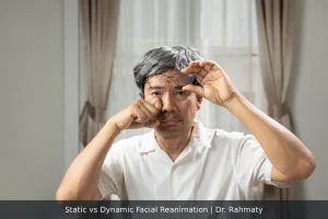 Static vs Dynamic Facial Reanimation